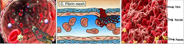 Hemostaza