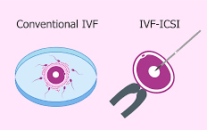 IVF Apo ICSI?