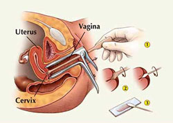 PAP Test