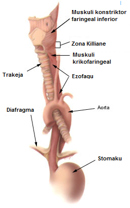 Refluksi Gastro-Ezofageal