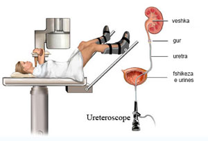 Procedurat Urologjike