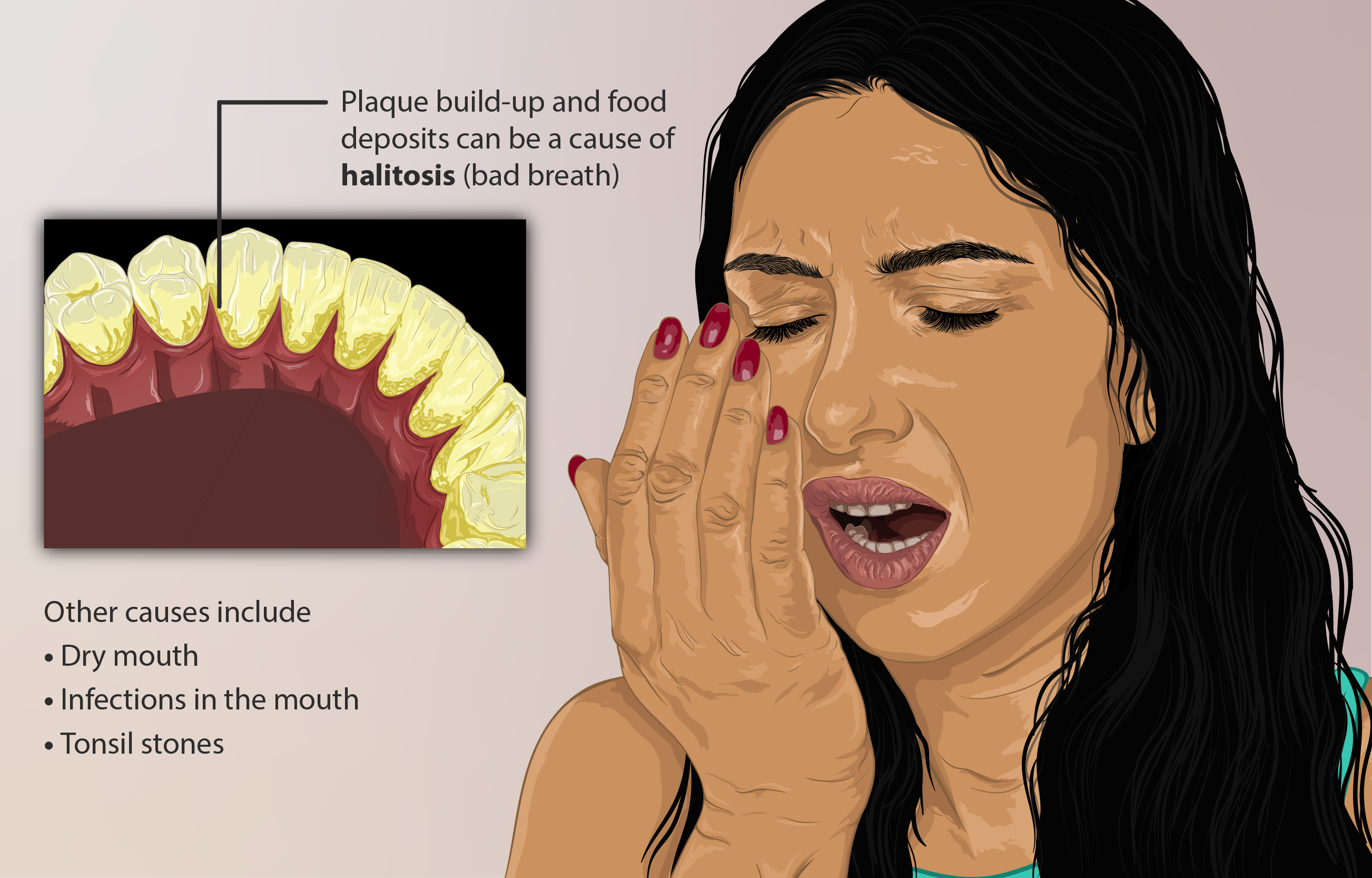 Era E Keqe E Frymës (Halitosis)