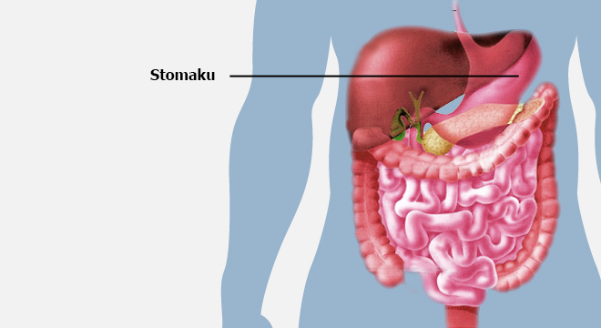 Gastro-enteriti Nga Noroviruset