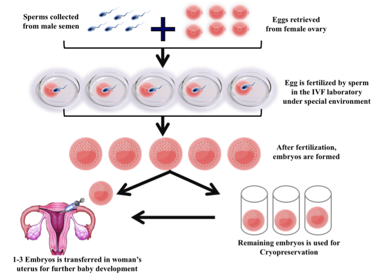 Ngrirja E Embrioneve: Çfarë Duhet Të Dimë Për Këtë Teknikë Të Fertilizimit In Vitro