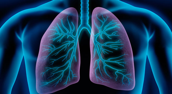 Bronkopneumopatia Obstruktive Kronike (BPOK, Sëmundja Pulmonare Obstruktive Kronike, SPOK)