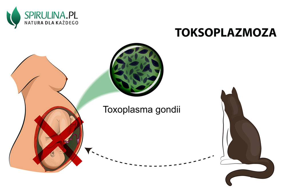 Toksoplazmoza