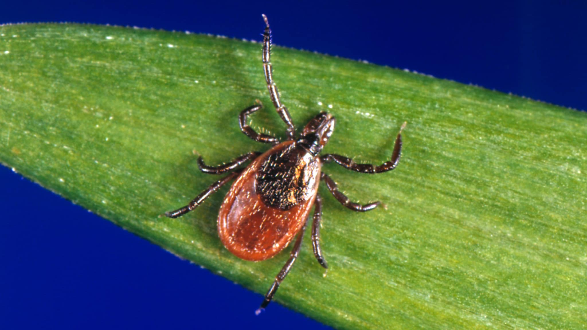 Borrelioza Lyme (Sëmundja Lyme)