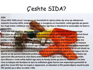 SIDA (AIDS, HIV, Sindromi I Defiçitit Imunitar Të Fituar)