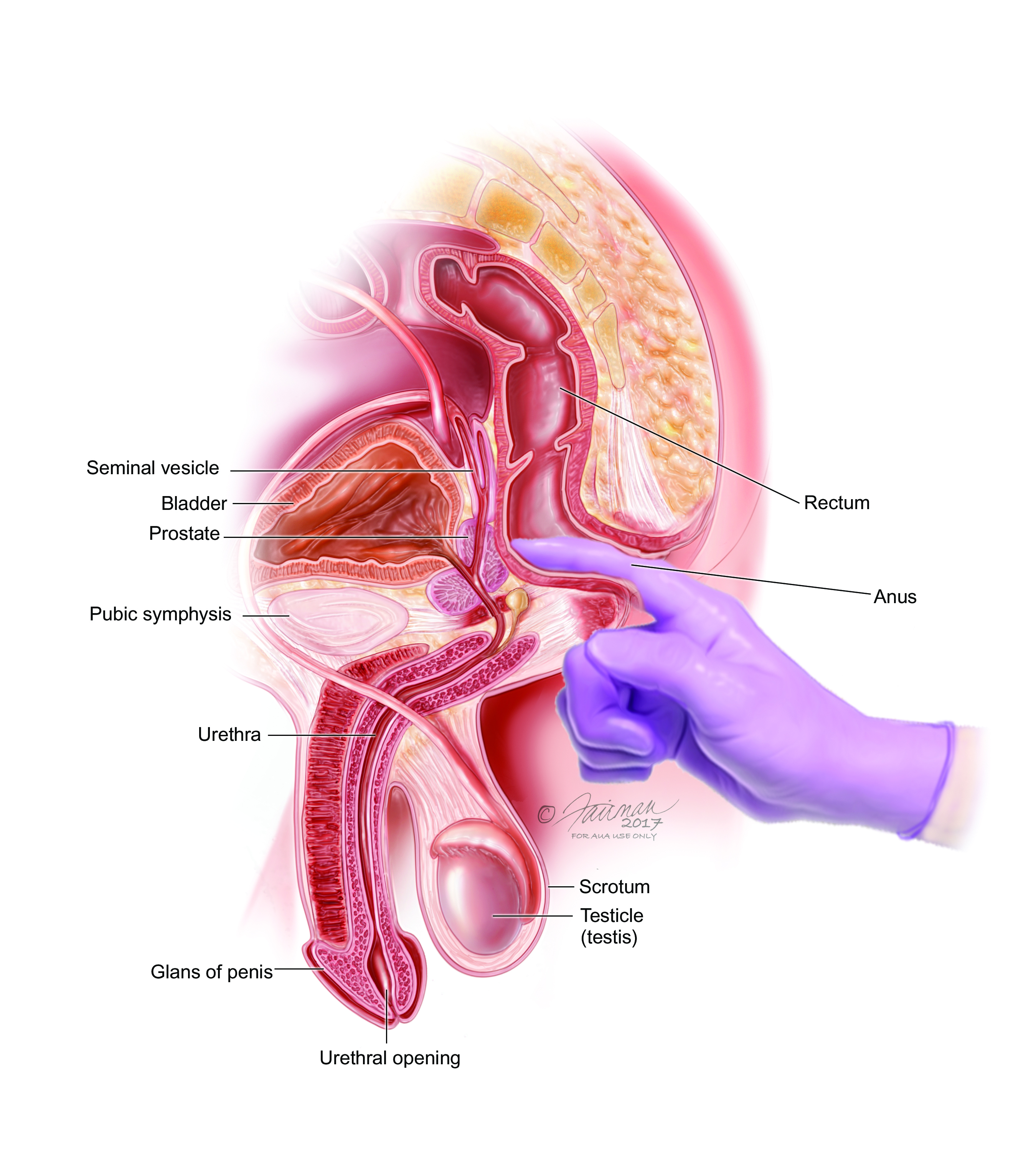 Çfarë duhet të dimë për kancerin e prostatës