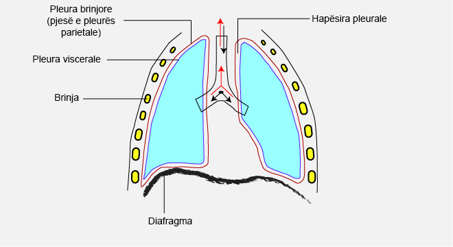 Pleuriti (Inflamacioni I Pleurës)