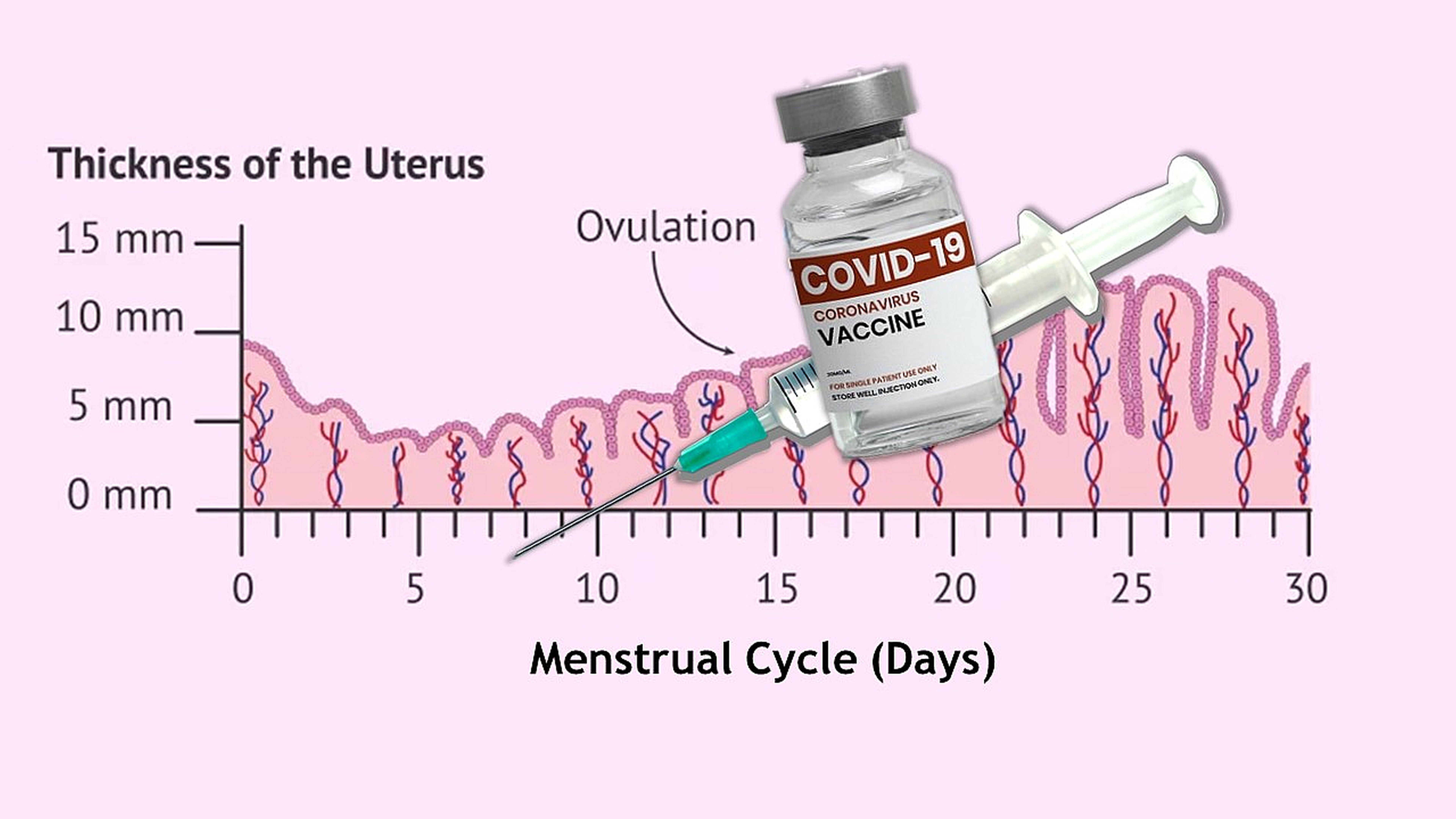 COVID i gjatë dhe cikli menstrual: Ndikimi i panjohur në mirëqenien e grave cover images